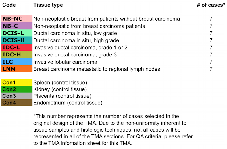 CHTN_BRCaProg2 Breast Cancer Progression Code Key in a Table