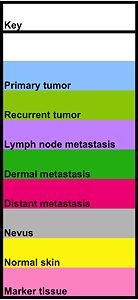 Cancer Diagnosis Program (CDP) Melanoma Progression TMA Key